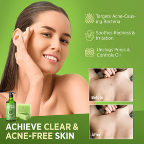 Roycederm soap bar texture close-up highlighting smooth creamy lather benefit