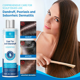RoyceDerm shampoo in use lathered on scalp for targeted relief