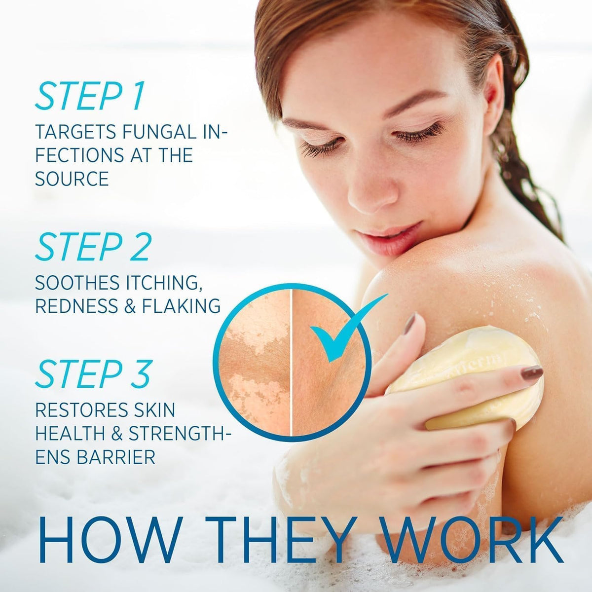 Roycederm soap in shower setting illustrating daily cleansing to reduce fungal-prone build-up