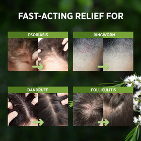 RoyceDerm fine mist texture demonstration providing instant cooling relief