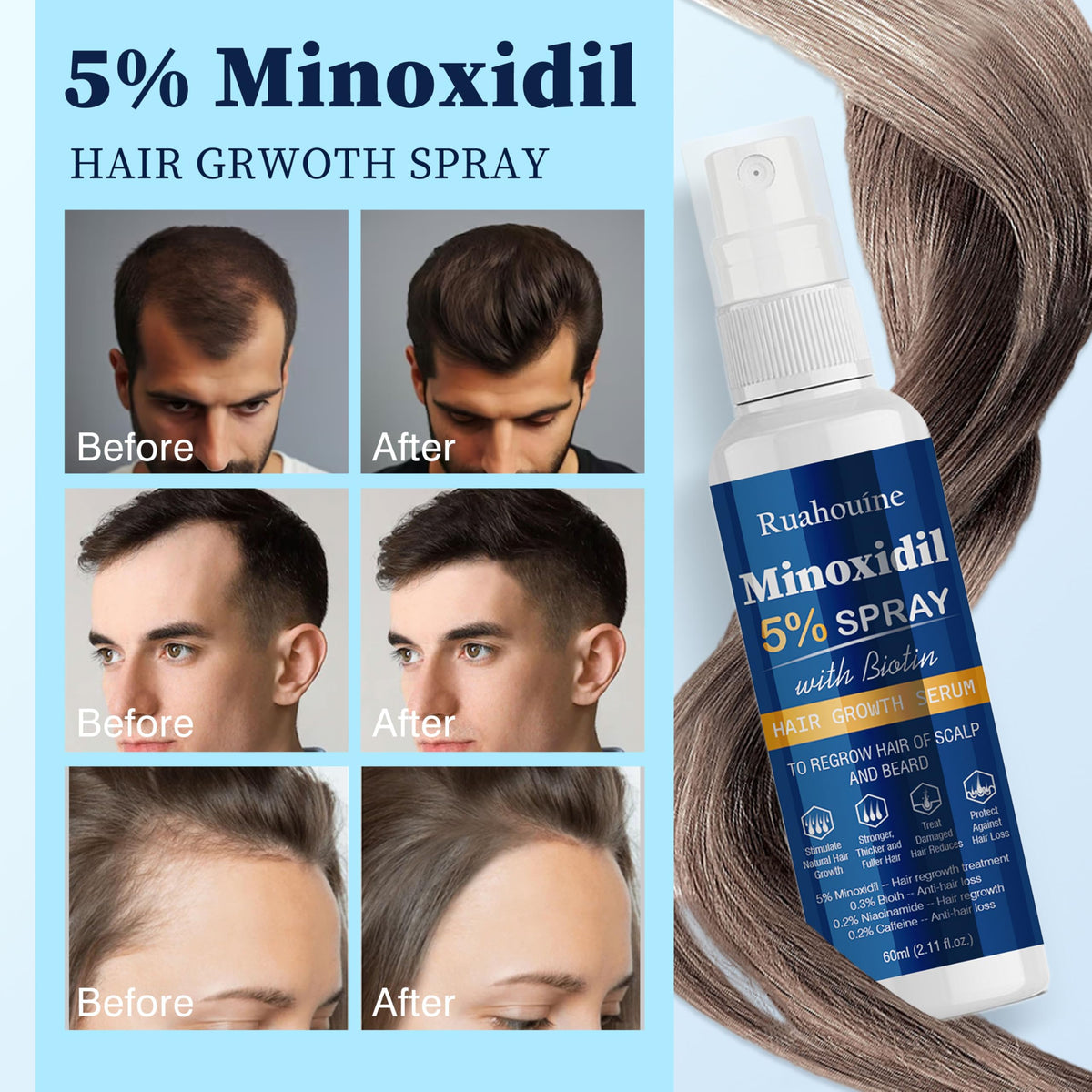 Ruahouine spray applied to scalp area illustrating targeted thinning coverage benefit