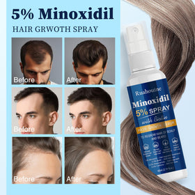 Ruahouine spray applied to scalp area illustrating targeted thinning coverage benefit