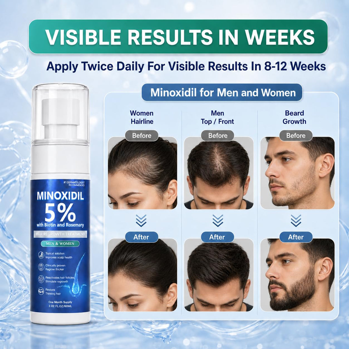 Rylx applied to scalp demonstrating easy twice-daily use for regrowth
