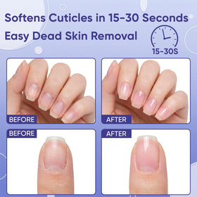 SASSYTIP applying gel to finger demonstrating fast softening benefit