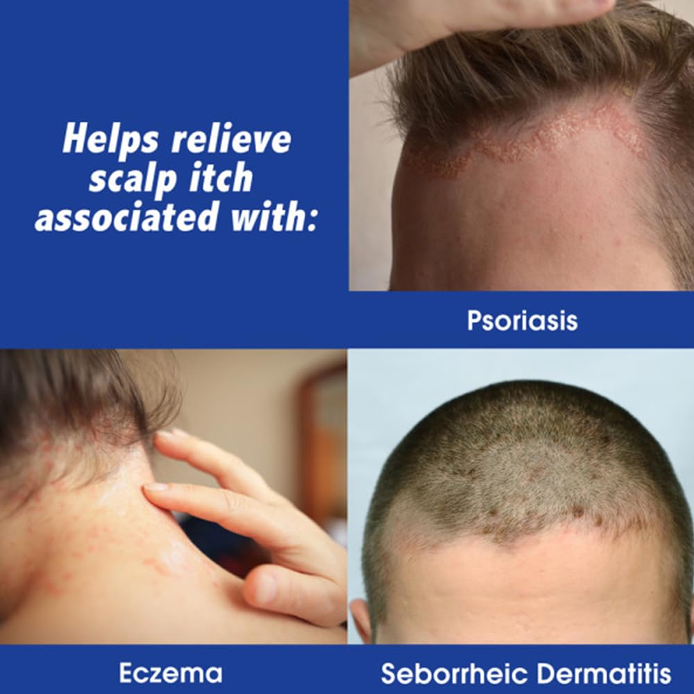 Scalpicin being applied to scalp illustrating direct soothing of irritated areas