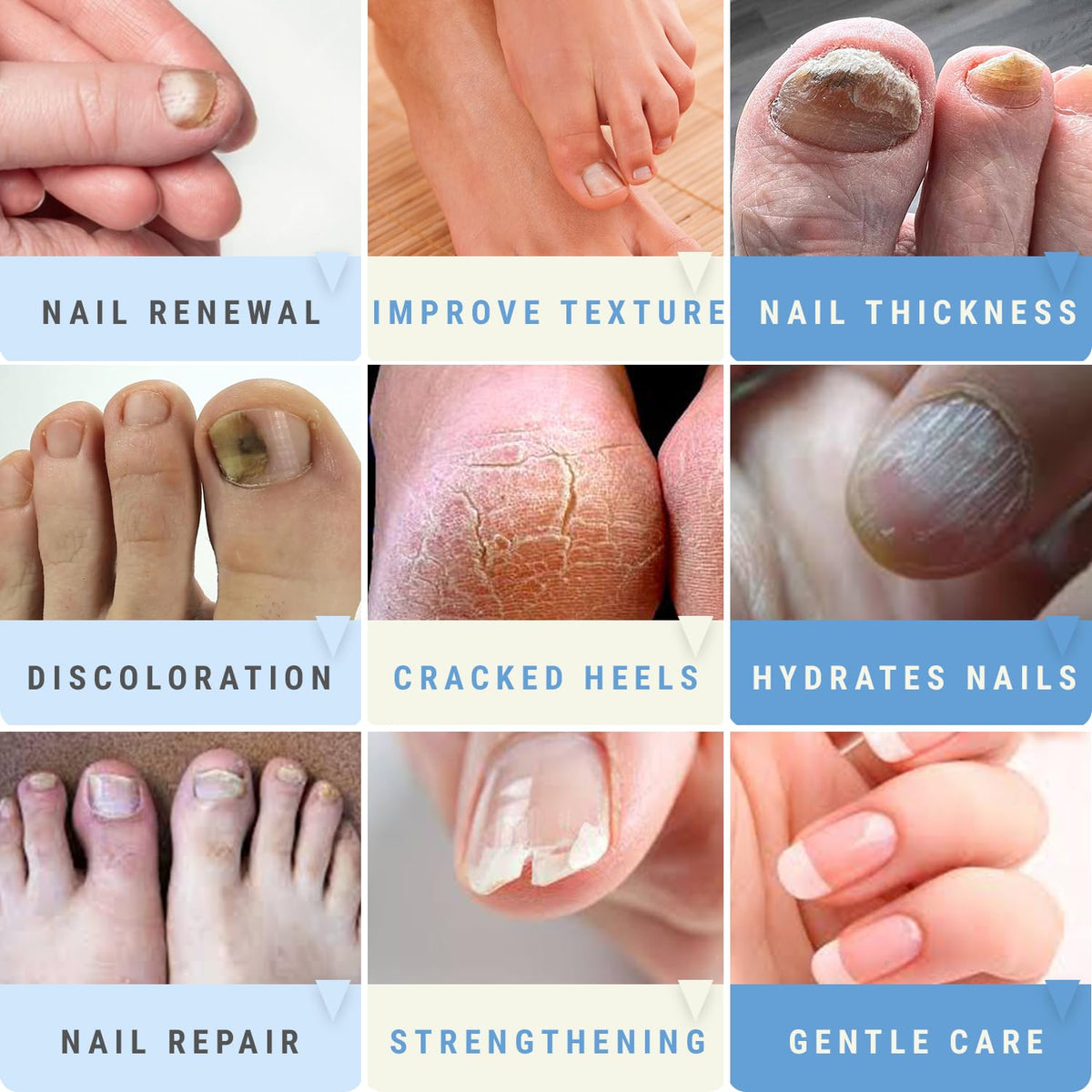 Scientific Solutions Global applied to toenail demonstrating targeted softening