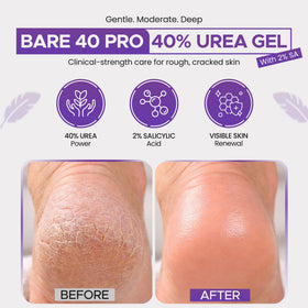 Scientific Solutions Global BARE 40 PRO ingredients display with urea, salicylic acid, hyaluronic acid for efficacy