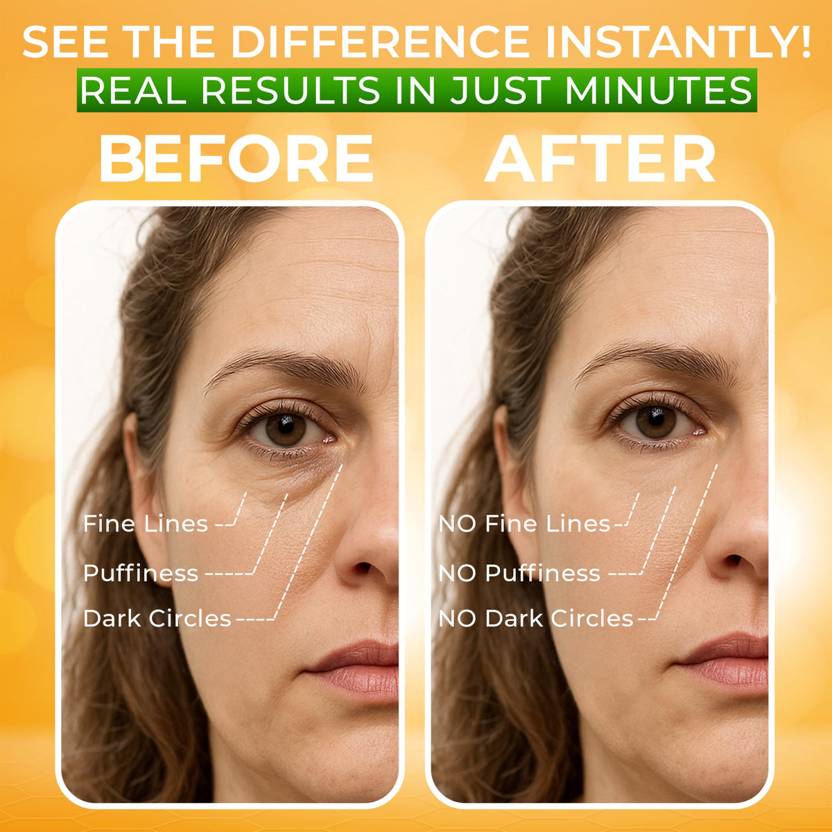 SEAMANTIKA before and after representation showing reduced puffiness appearance