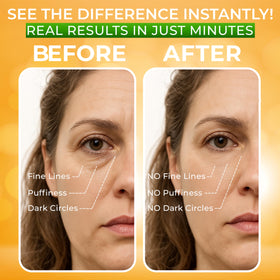 SEAMANTIKA before and after representation showing reduced puffiness appearance