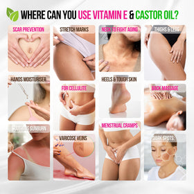 SELFWISE applied to belly demonstrating stretch-mark massage and soothing hydration