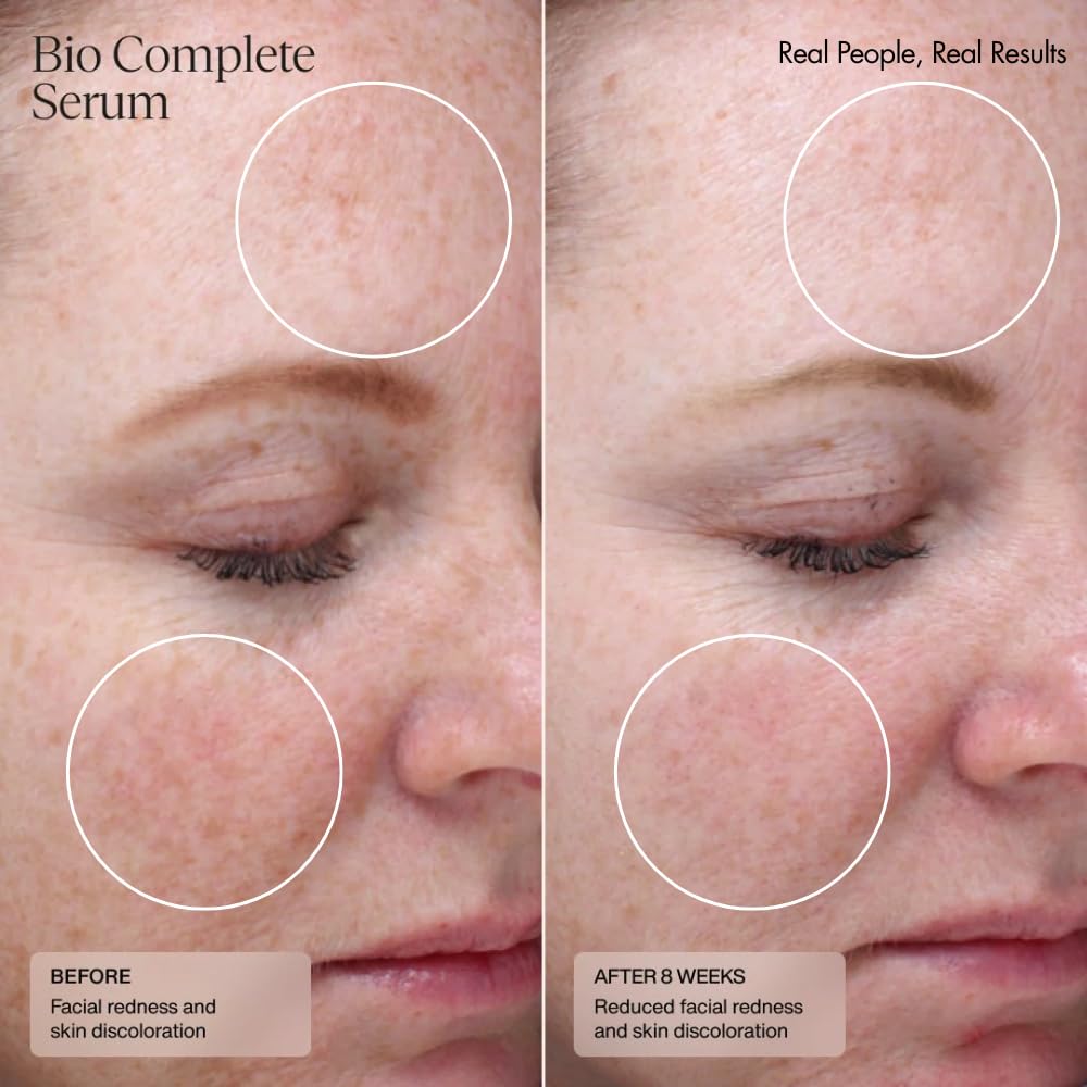 Sente Bio Complete Serum applied in evening skincare routine for calming nightly use
