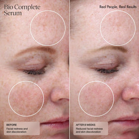 Sente Bio Complete Serum applied in evening skincare routine for calming nightly use