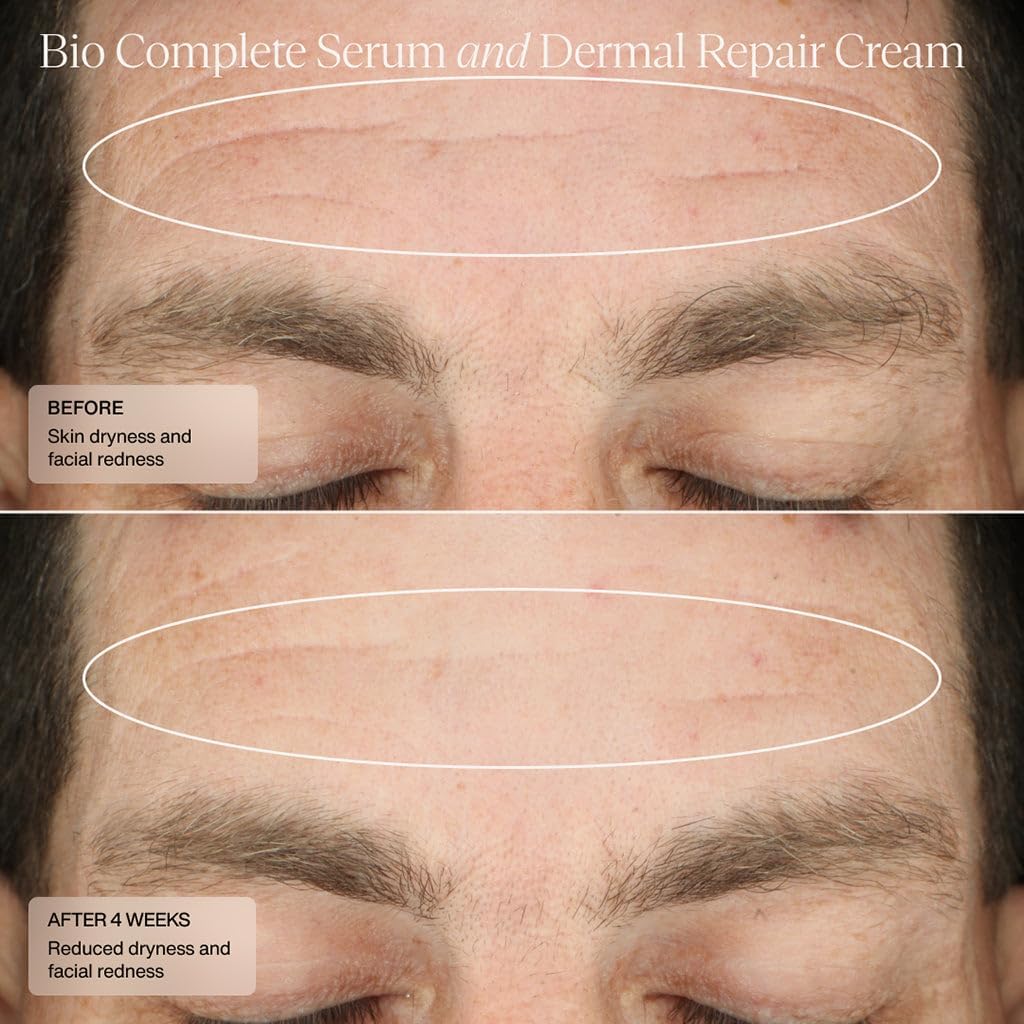 Sente Bio Complete Serum schematic showing improved texture and evenness over time