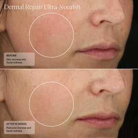 Sente close-up label showing formulation details and skin-supporting benefit