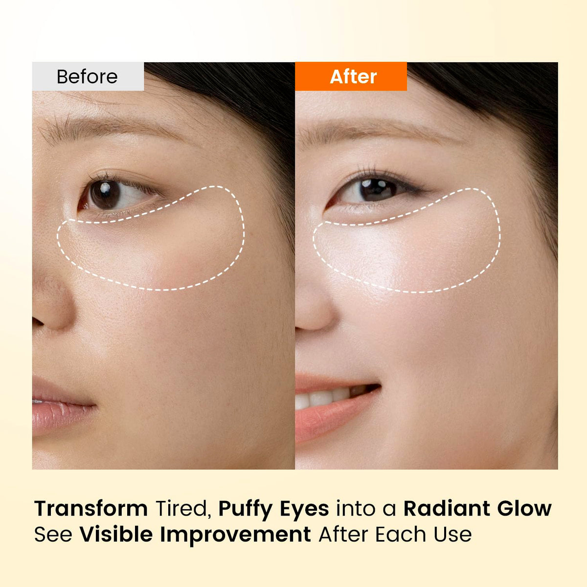 SEONGLOW application on under-eye demonstrating secure comfortable fit