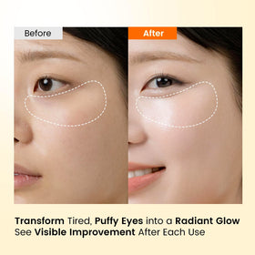 SEONGLOW application on under-eye demonstrating secure comfortable fit