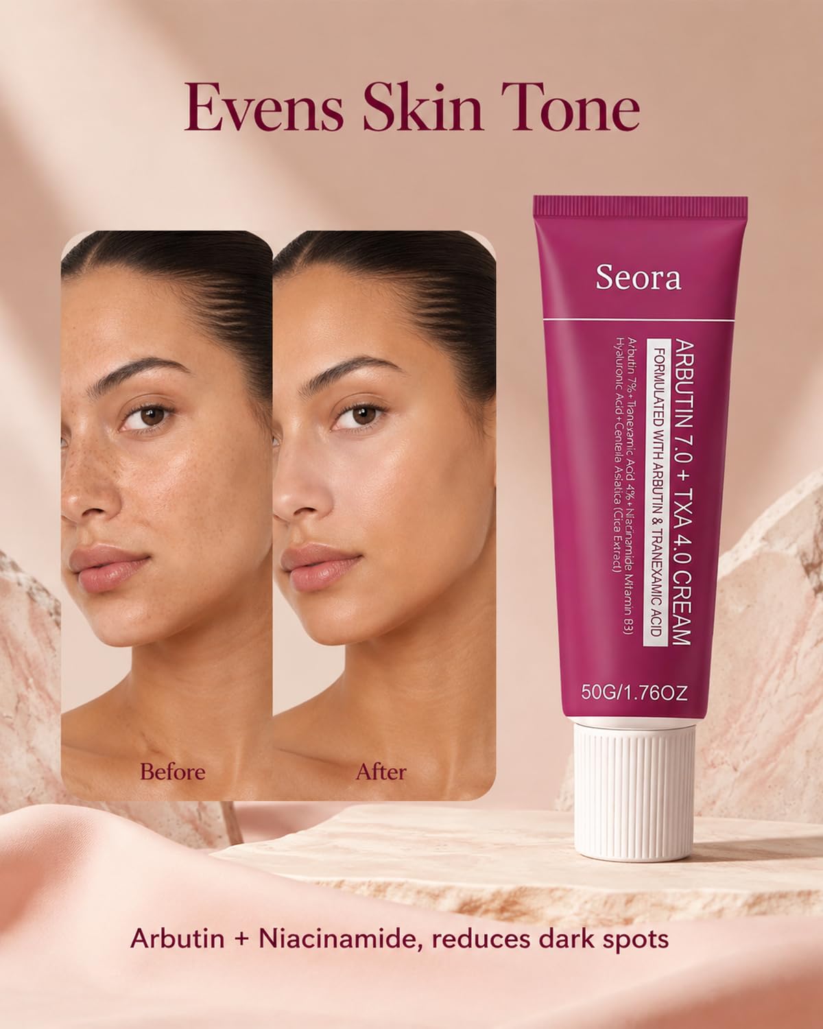 Seora Cream close-up of label highlighting arbutin and niacinamide benefits