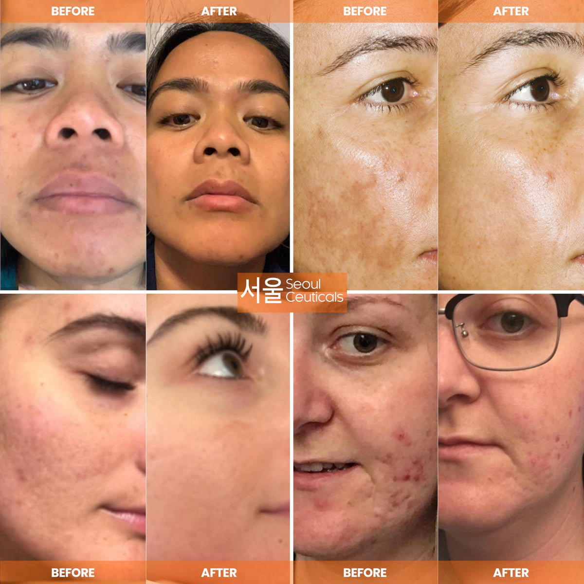 SeoulCeuticals serum texture on skin, demonstrates lightweight hydration