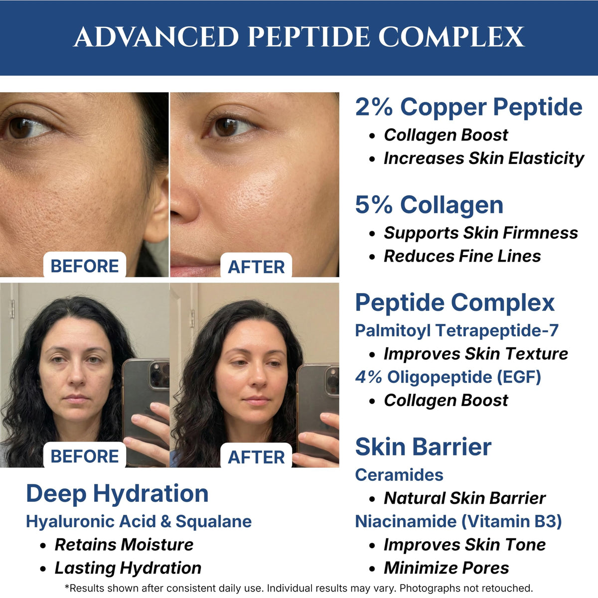 Seraphime label zoom on ingredient highlights, emphasizing peptide complex benefit