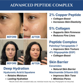 Seraphime label zoom on ingredient highlights, emphasizing peptide complex benefit