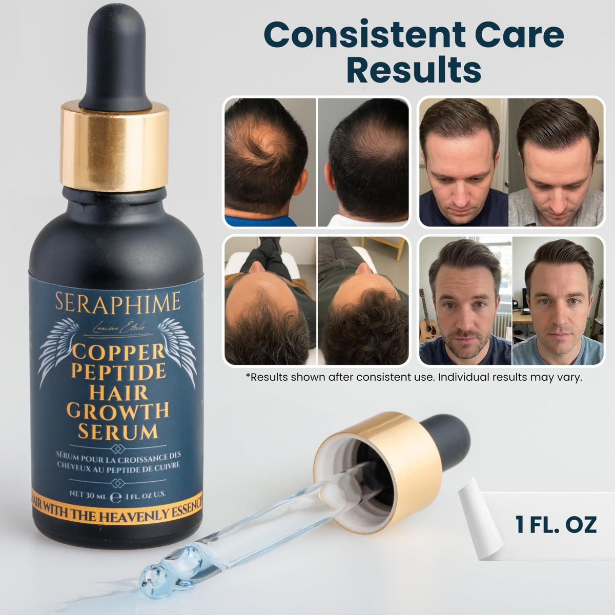 Seraphime next to a ruler showing 1 fl oz size for easy scale and travel-friendly benefit