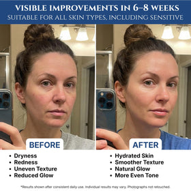 Seraphime serum texture close-up on skin, illustrating lightweight hydration benefit