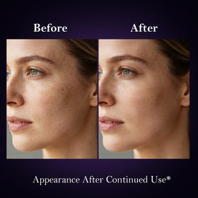 SerenSkin being smoothed on face to reduce dark spots
