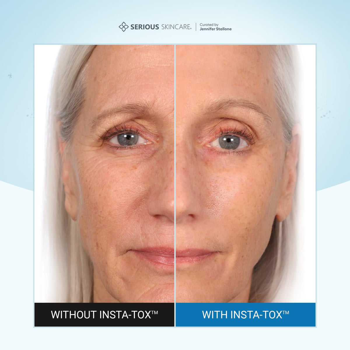Serious Skincare application under eye demonstrating targeted wrinkle smoothing