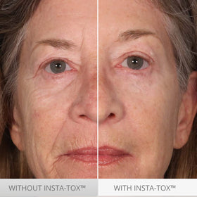 Serious Skincare applied under-eye area demonstrating temporary tightening effect