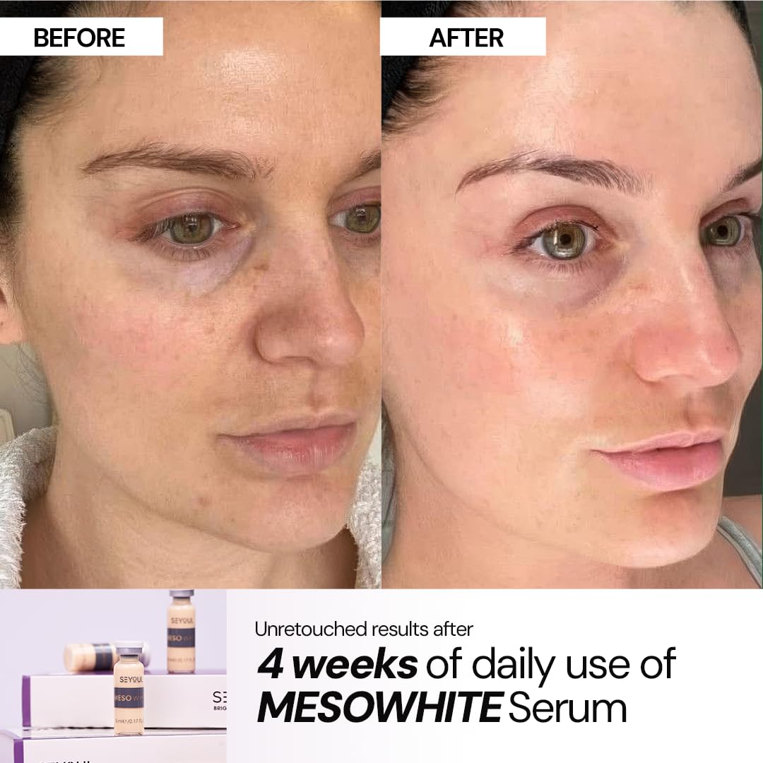 SEYOUL ampoule held in hand showing vial size and easy application