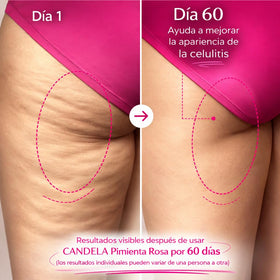SHAEIO CANDELA applied to thigh showing smoothing and targeting benefit