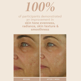 SHANI DARDEN ingredient label focusing on encapsulated retinol and peptides
