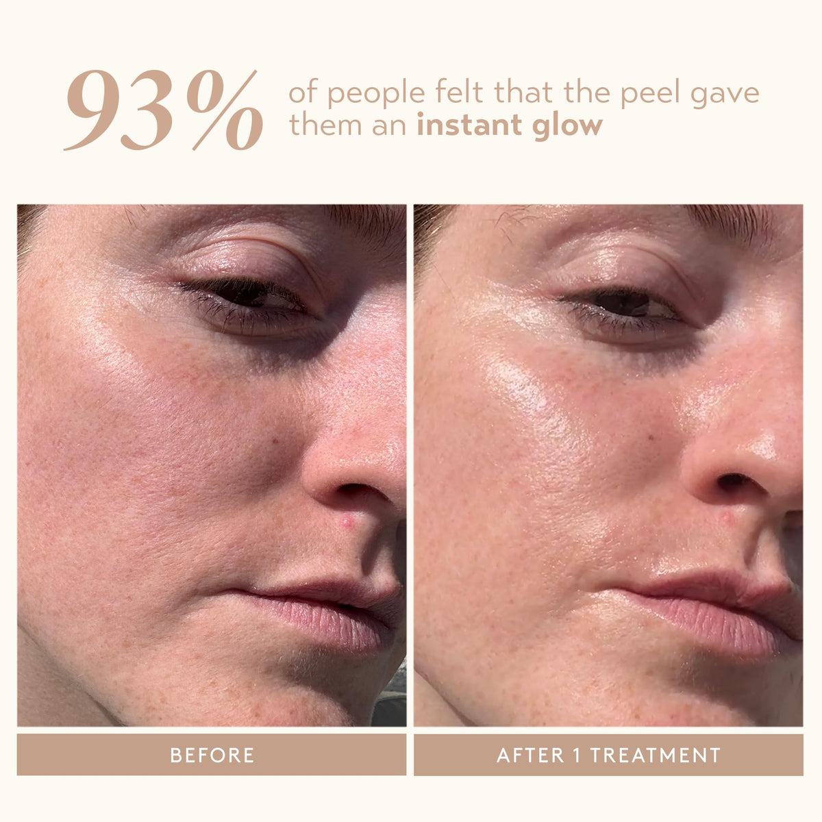 SHANI DARDEN step one application on cleansed skin demonstrating controlled exfoliation