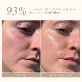 SHANI DARDEN step one application on cleansed skin demonstrating controlled exfoliation