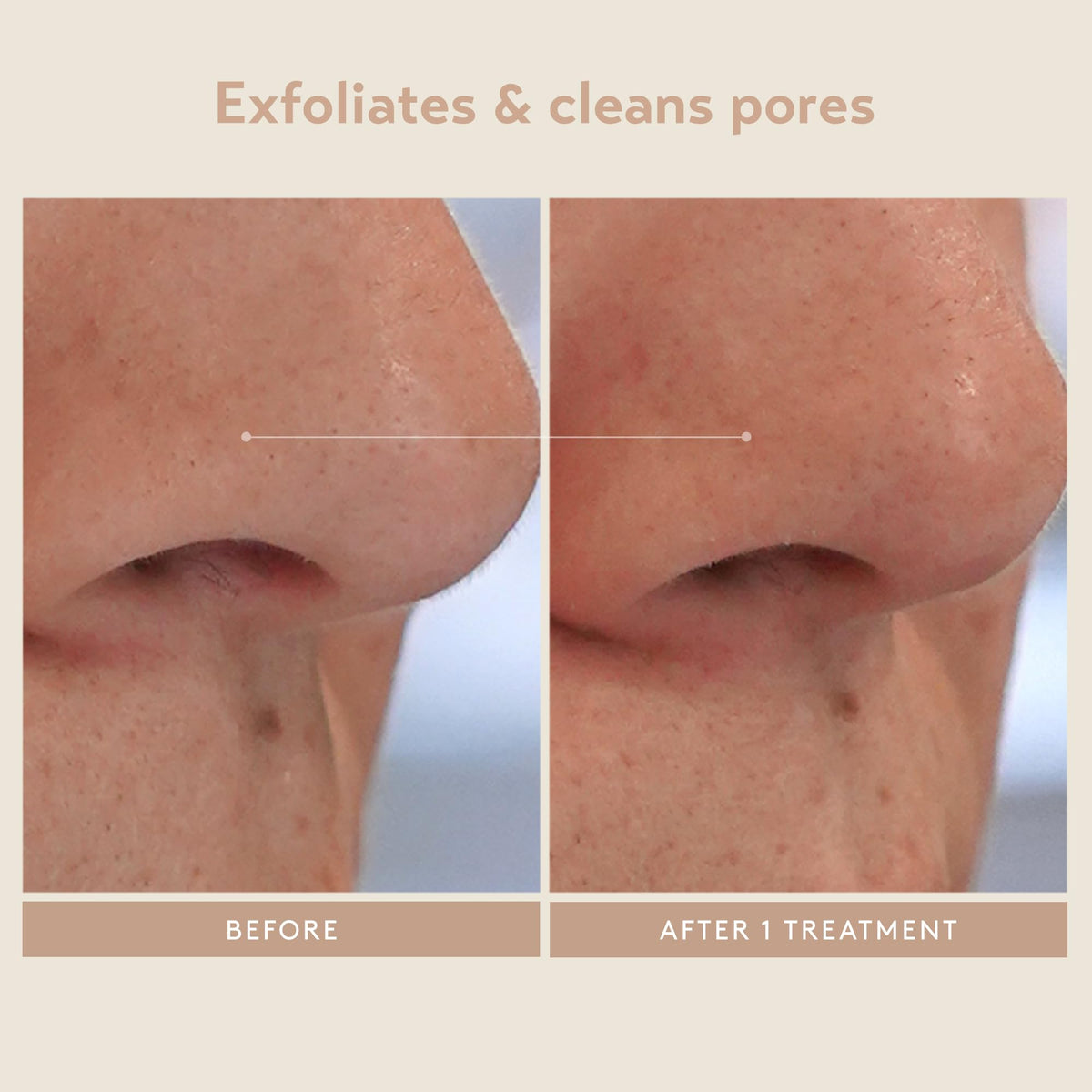 SHANI DARDEN mask massaged into skin showing soothing neutralizer and pore-clearing benefit