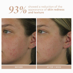 SHANI DARDEN applying serum to face showing smooth absorption and layering