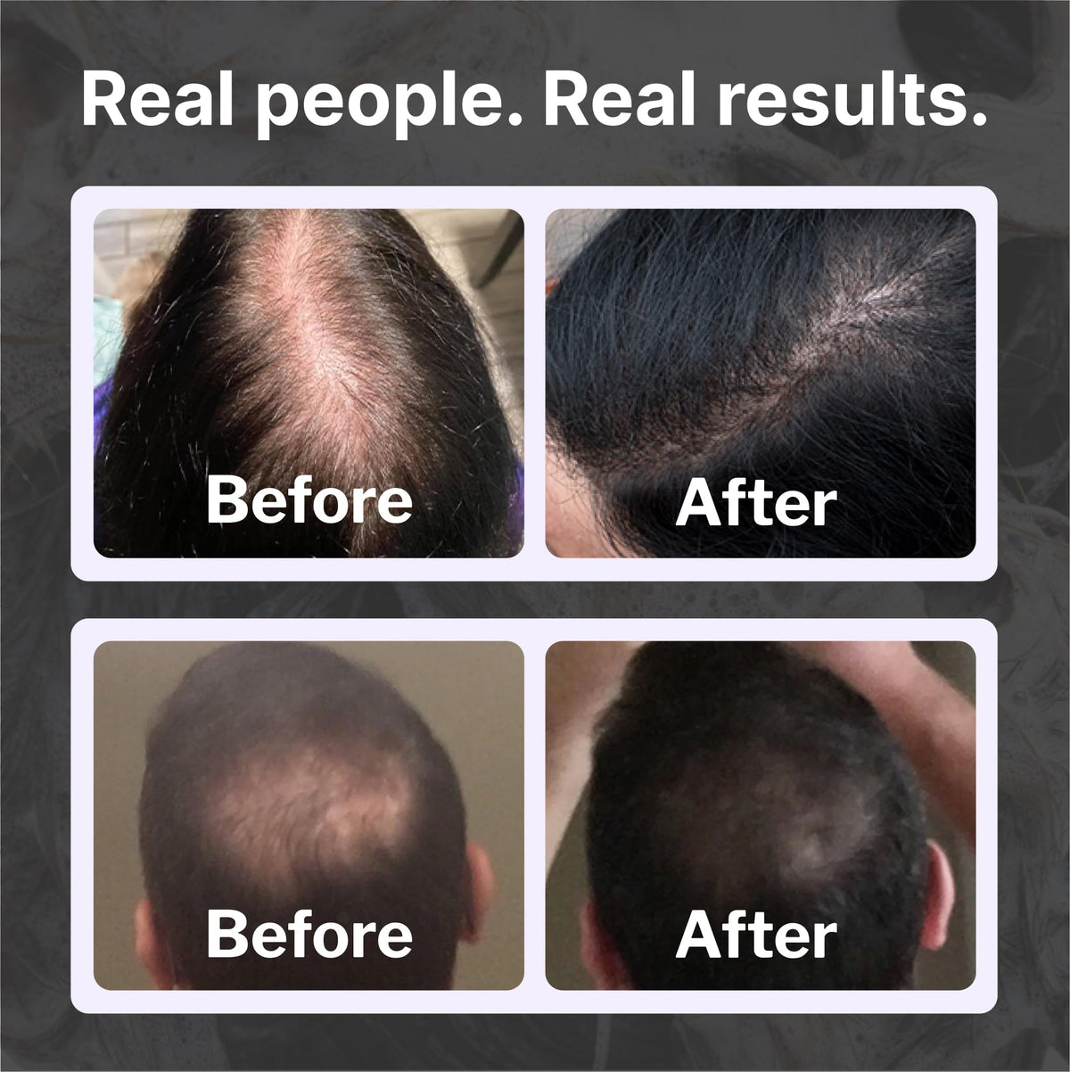 Shapiro MD bottle label detail showing dermatologist-developed formulation