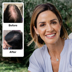 Shapiro MD conditioner cream texture closeup showing moisturizing strand benefits