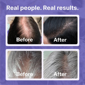 Shapiro MD shampoo bottle label detail highlighting gentle, sulfate-free formula