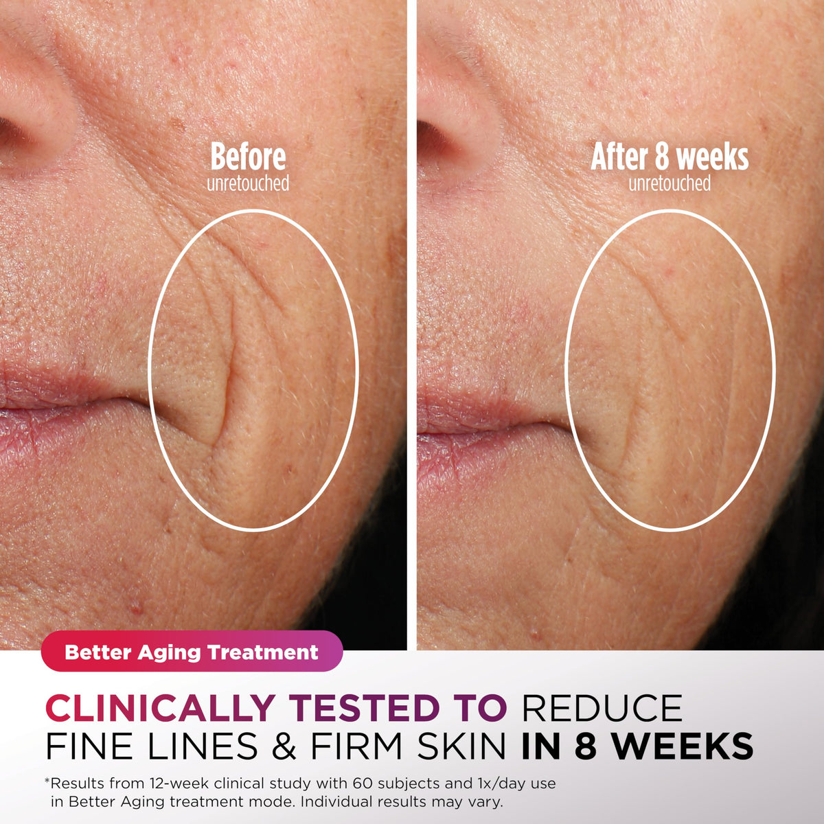 Shark CryoGlow in use during morning routine showing quick clinical-style treatment