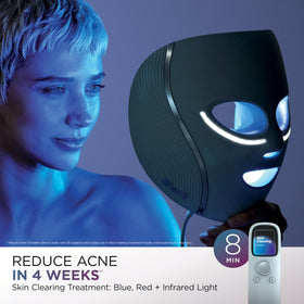 Shark CryoGlow held in hand showing compact scale and at-home usability benefit