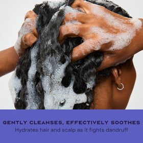 SheaMoisture before and after scalp view showing reduced flakes