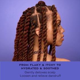 SheaMoisture before and after scalp image showing reduced visible flakes