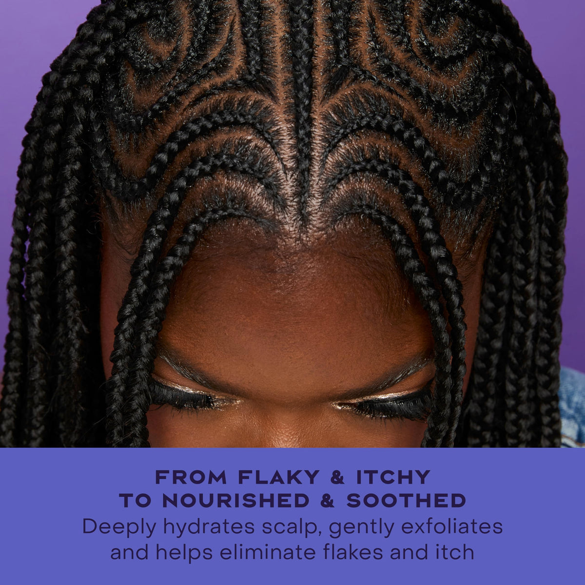 SheaMoisture before and after scalp comparison highlighting reduced flakes and comfort