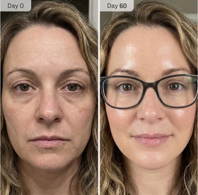 Shining Face application demo on neck illustrating targeted use and smoother appearance