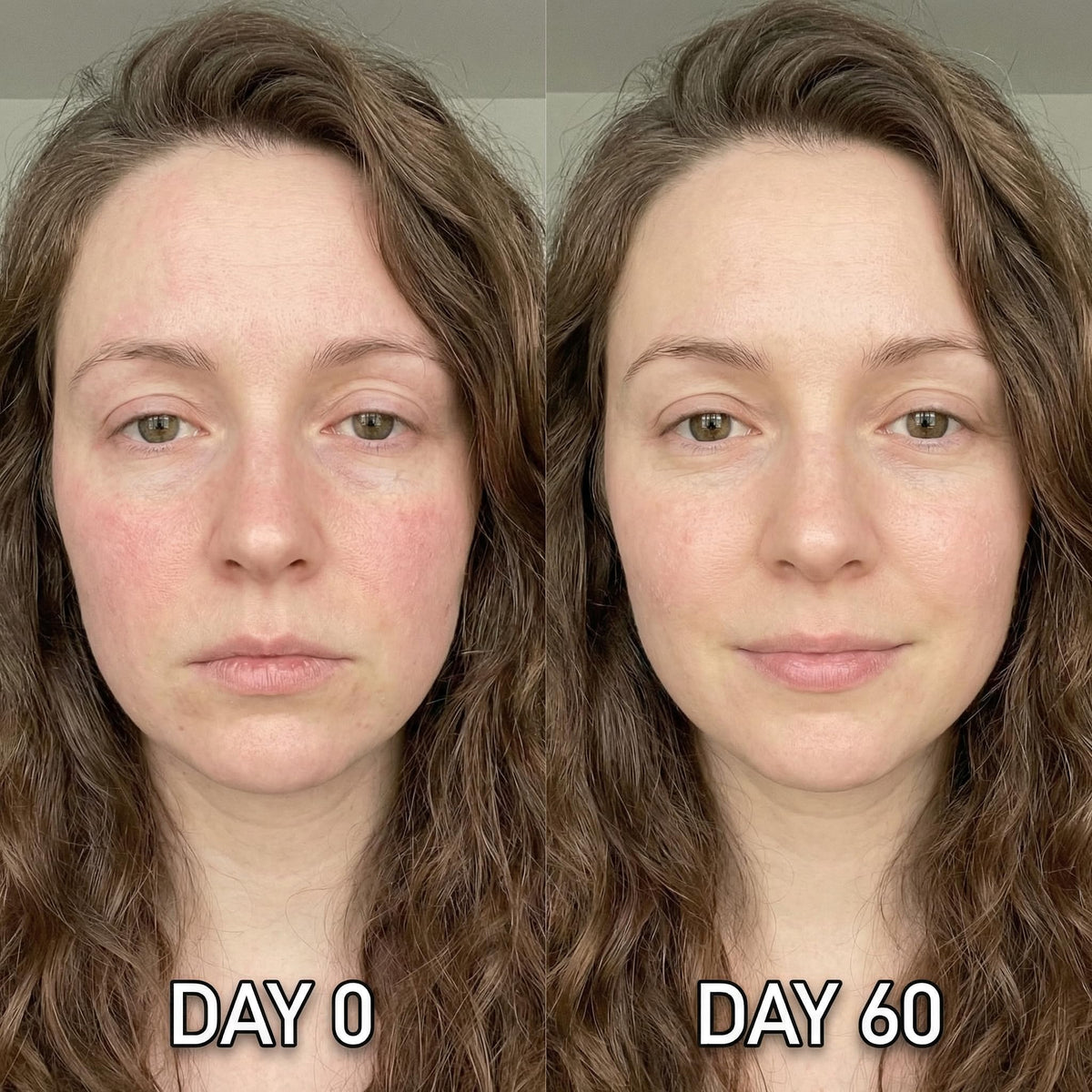 Shining Face kit contents laid out to show stamp, applicators, and eight serums