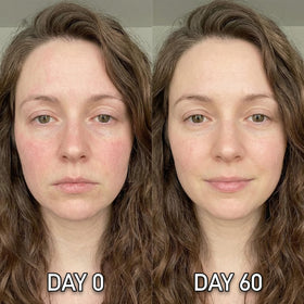 Shining Face kit contents laid out to show stamp, applicators, and eight serums