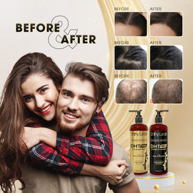 Shiny Leaf botanical extracts display highlighting natural DHT-blocking ingredients