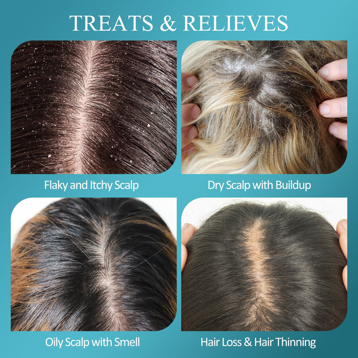 SHVYOG silicone scalp massager included with scrub for improved circulation and coverage