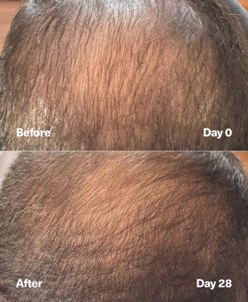 SickScience before and after style showing fuller-looking part and crown
